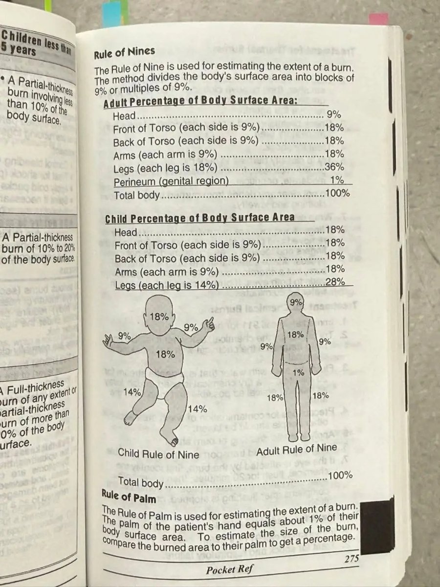 Children less than 5 years &bull; A Partial-thickness burn involving less than 10% of the body surface. A Partial-thickness burn of 10% to 20% of the body surface. Full-thickness urn of any extent or artial-thickness urn of more than 0% of the body urface. 9% 18% 18% 18% 36% 1% Rule of Nines The Rule of Nine is used for estimating the extent of a burn. The method divides the body's surface area into blocks of 9% or multiples of 9%. Adult Percentage of Body Surface Area: Head Front of Torso (each side is 9%). Back of Torso (each side is 9%) Arms (each arm is 9%) Legs (each leg is 18%) .. Perineum (genital region) Total body.. . 100% Child Percentage of Body Surface Area Head Front of Torso (each side is 9%) Back of Torso (each side is 9%) Arms (each arm is 9%) Legs (each leg is 14%) 9% * 18% 9% /S 18% 18% 18% 18% 28% 9% 18% 9%/ 9% 18% 1% 14% 18% 18% 14% Child Rule of Nine Adult Rule of Nine 100% Total body .. Rule of Palm The Rule of Palm is used for estimating the extent of a burn. The palm of the patient's hand equals about 1% of their body surtace area. To estimate the size of the burn, compare the burned area to their palm to get a percentage. 275 Pocket Ref